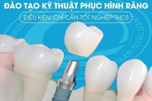 Những điểm sáng của ngành kỹ thuật phục hình răng