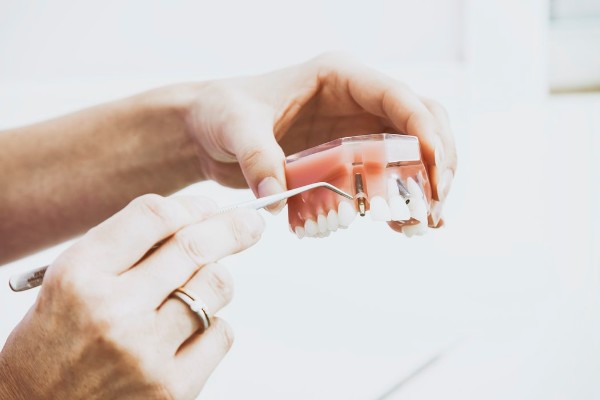 Thời gian đào tạo Kỹ thuật phục hình răng tuỳ từng cấp bậc học